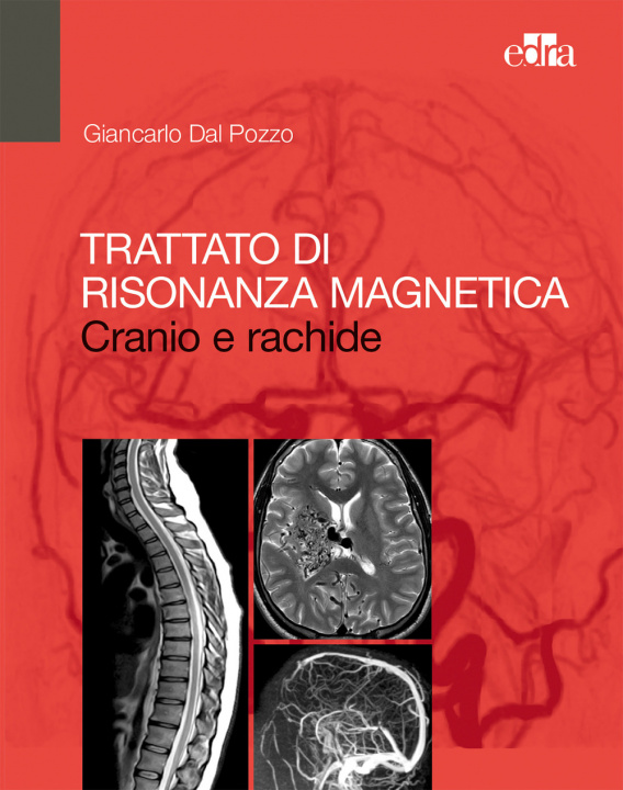 Könyv Trattato di risonanza magnetica. Cranio e rachide Giancarlo Dal Pozzo