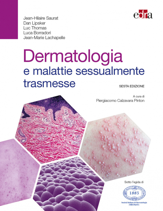 Kniha Dermatologia e malattie sessualmente trasmesse Jean-Hilaire Saurat