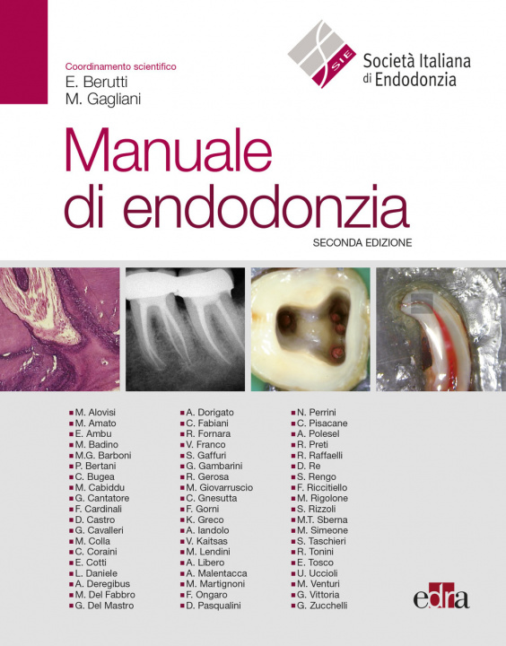 Книга Manuale di endodonzia 