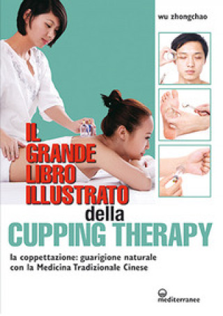 Carte grande libro illustrato della cupping therapy. La coppettazione: guarigione naturale con la Medicina Tradizionale Cinese Zhongchao Wu