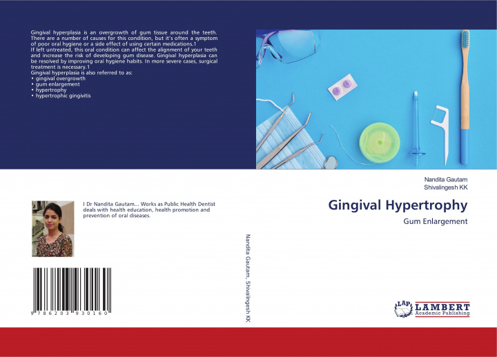 Knjiga Gingival Hypertrophy Shivalingesh Kk