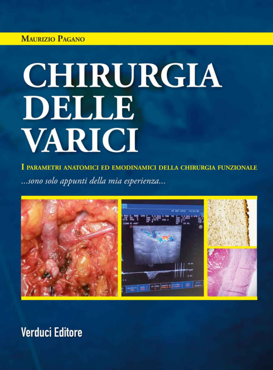 Kniha Chirurgia delle varici. I parametri anatomici ed emodinamici della chirurgia funzionale Maurizio Pagano