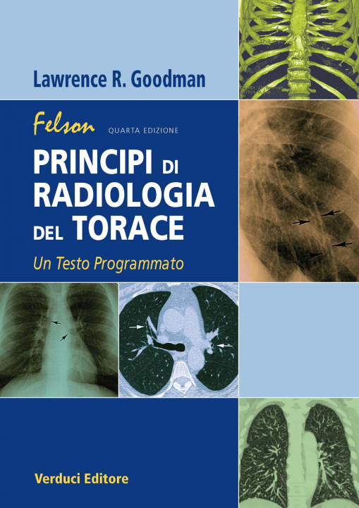 Carte Felson. Principi di radiologia del torace. Un testo programmato Lawrence R. Goodman