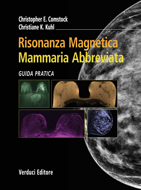 Carte Risonanza magnetica mammaria abbreviata. Guida pratica Christopher E. Comstock