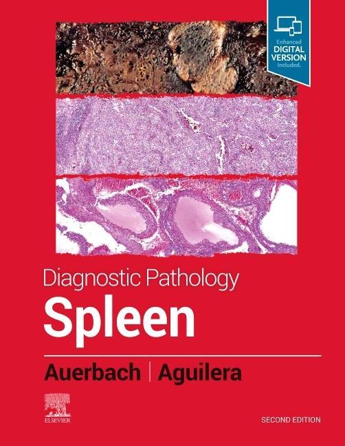 Knjiga Diagnostic Pathology: Spleen Aaron Auerbach