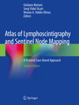 Kniha Atlas of Lymphoscintigraphy and Sentinel Node Mapping Renato A. Valdés Olmos