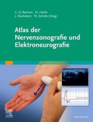 Knjiga Atlas der Nervensonografie und Elektroneurografie Jochen Machetanz