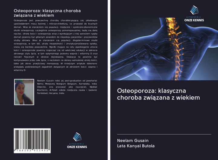 Kniha Osteoporoza: klasyczna choroba zwi?zana z wiekiem Lata Kanyal Butola