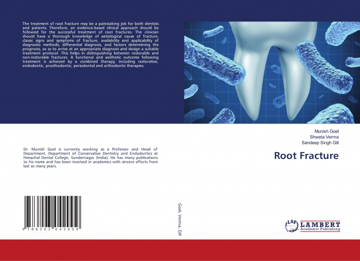 Книга Root Fracture Shweta Verma