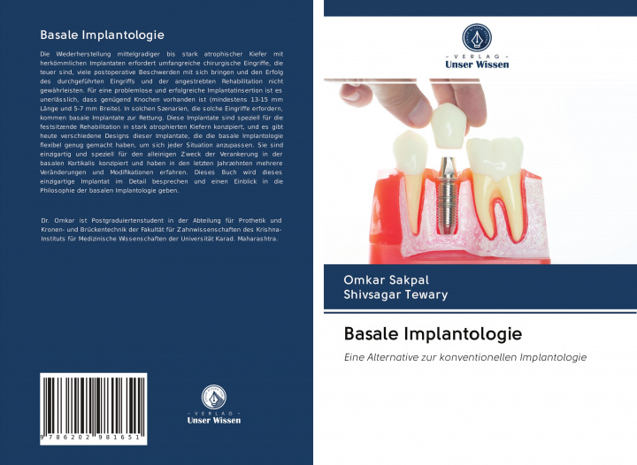 Book Basale Implantologie Shivsagar Tewary