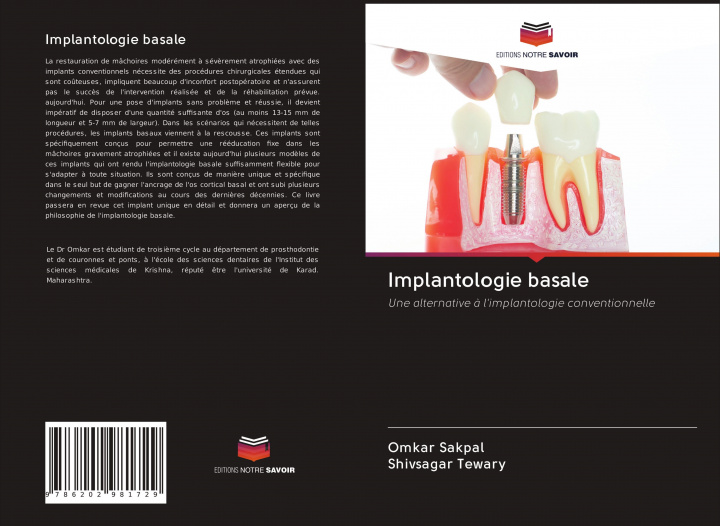 Kniha Implantologie basale Shivsagar Tewary