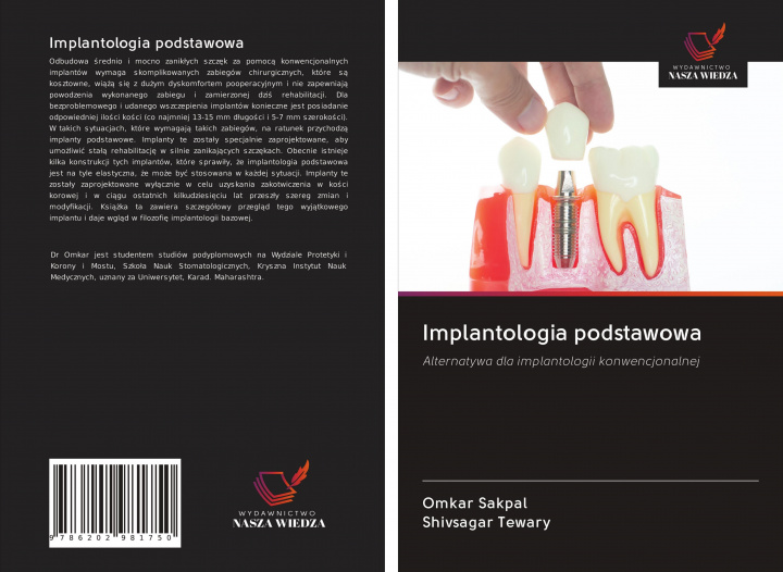 Kniha Implantologia podstawowa Shivsagar Tewary