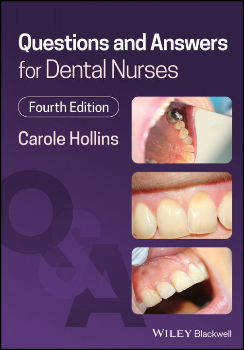 Könyv Questions and Answers for Dental Nurses 4th Edition Carole Hollins