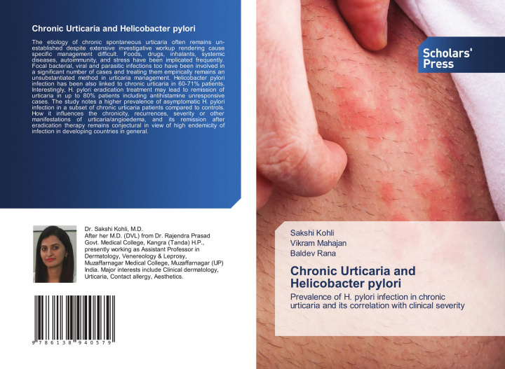 Könyv Chronic Urticaria and Helicobacter pylori Vikram Mahajan
