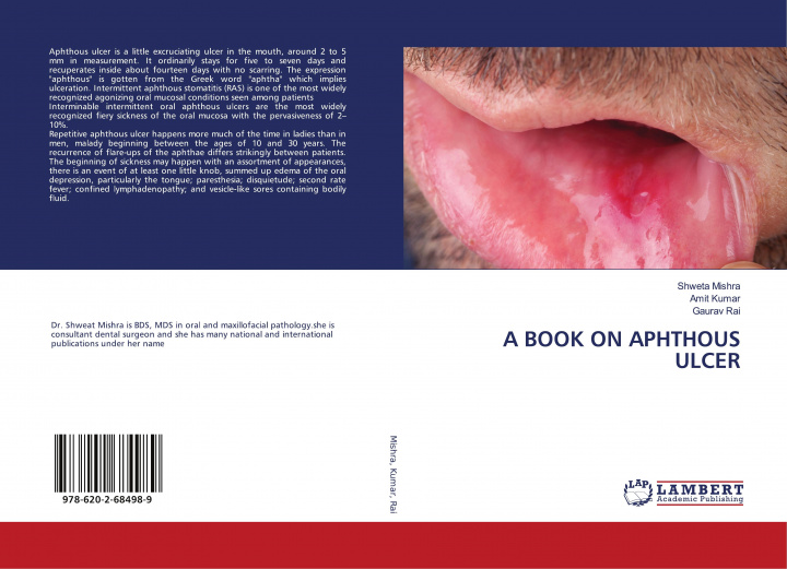 Buch A BOOK ON APHTHOUS ULCER Amit Kumar