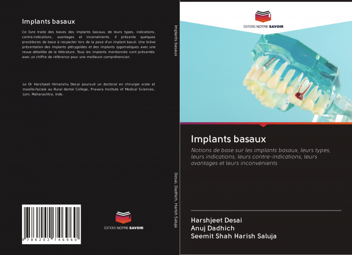 Knjiga Implants basaux Anuj Dadhich