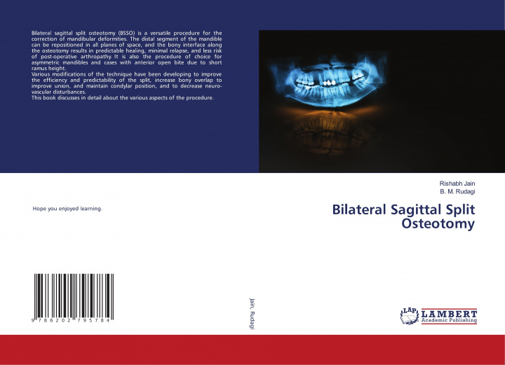 Kniha Bilateral Sagittal Split Osteotomy B. M. Rudagi