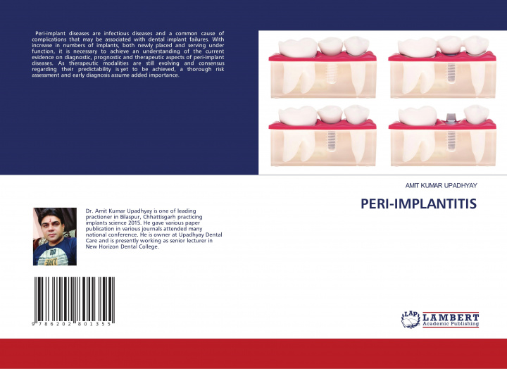 Buch PERI-IMPLANTITIS AMIT KUMAR UPADHYAY