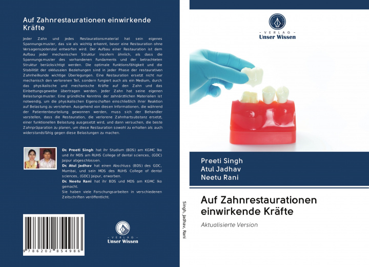 Buch Auf Zahnrestaurationen einwirkende Kräfte Atul Jadhav