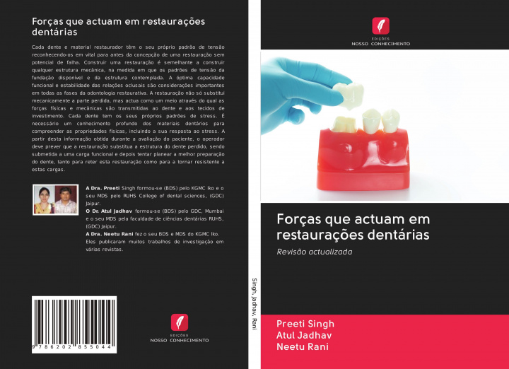 Buch Forças que actuam em restauraç?es dentárias Atul Jadhav