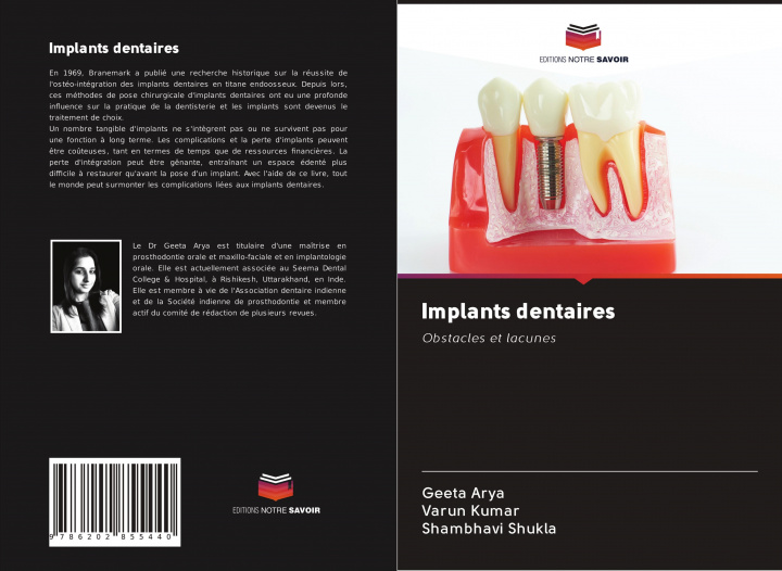 Book Implants dentaires Varun Kumar