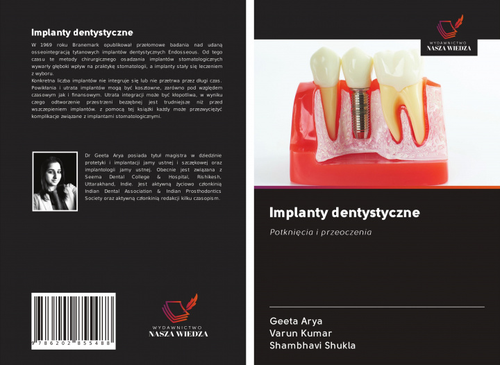 Könyv Implanty dentystyczne Varun Kumar