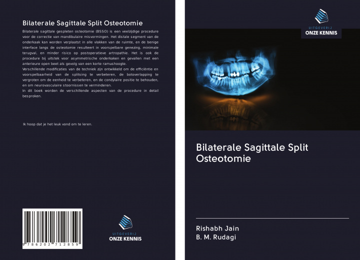 Kniha Bilaterale Sagittale Split Osteotomie B. M. Rudagi