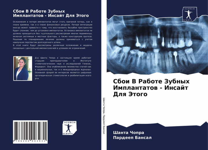 Kniha Sboi V Rabote Zubnyh Implantatow - Insajt Dlq Jetogo Pardeep Bansal