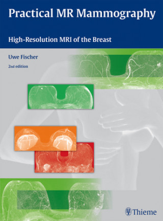 Kniha Practical MR Mammography Uwe Fischer