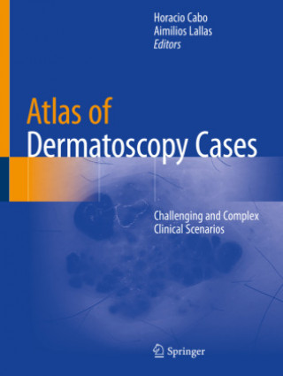 Könyv Atlas of Dermatoscopy Cases Horacio Cabo