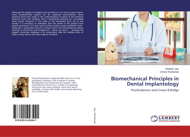 Knjiga Biomechanical Principles in Dental Implantology Chhavi Kharbanda