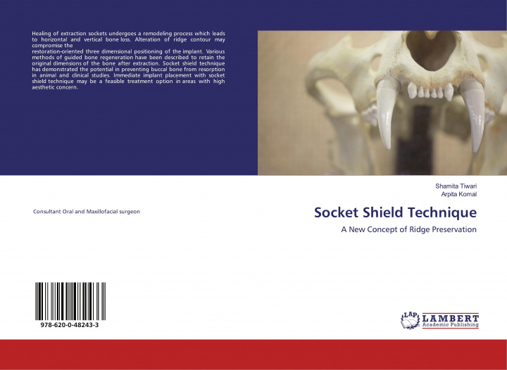 Carte Socket Shield Technique Arpita Komal