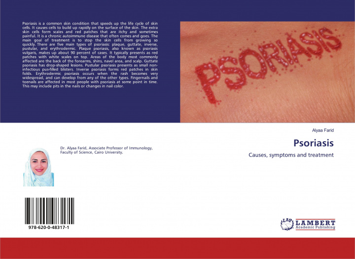 Knjiga Psoriasis 