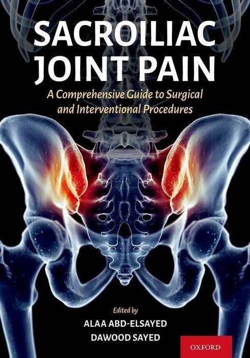 Kniha Sacroiliac Joint Pain 