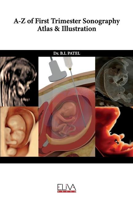 Kniha A-Z of First Trimester Sonography Atlas & Illustration 
