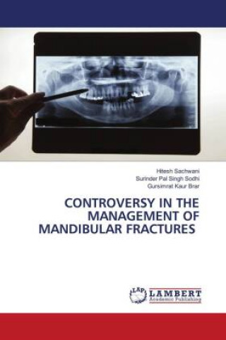 Carte CONTROVERSY IN THE MANAGEMENT OF MANDIBULAR FRACTURES Surinder Pal Singh Sodhi