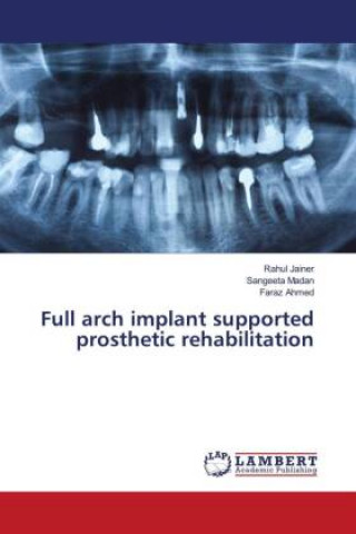 Книга Full arch implant supported prosthetic rehabilitation Sangeeta Madan