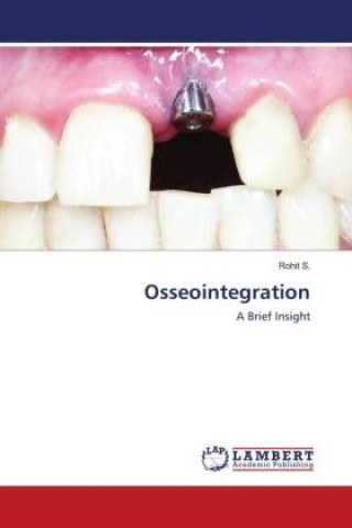 Knjiga Osseointegration Rohit S.