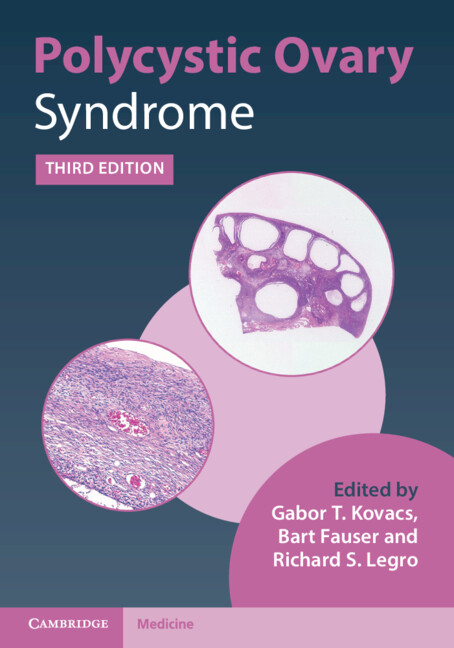 Kniha Polycystic Ovary Syndrome 