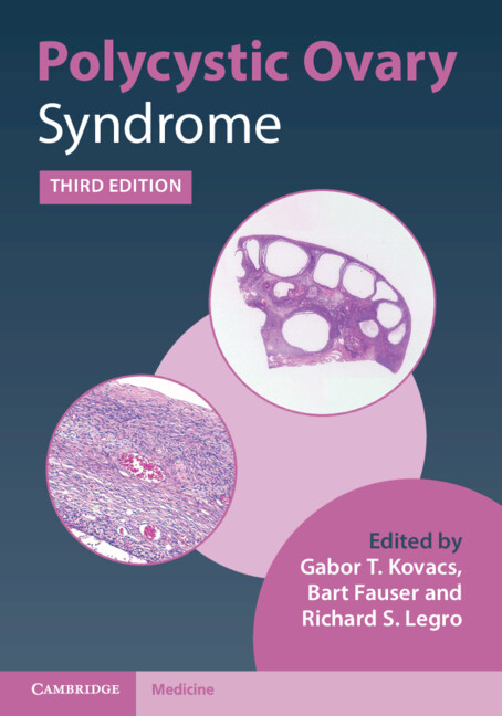 Libro Polycystic Ovary Syndrome 