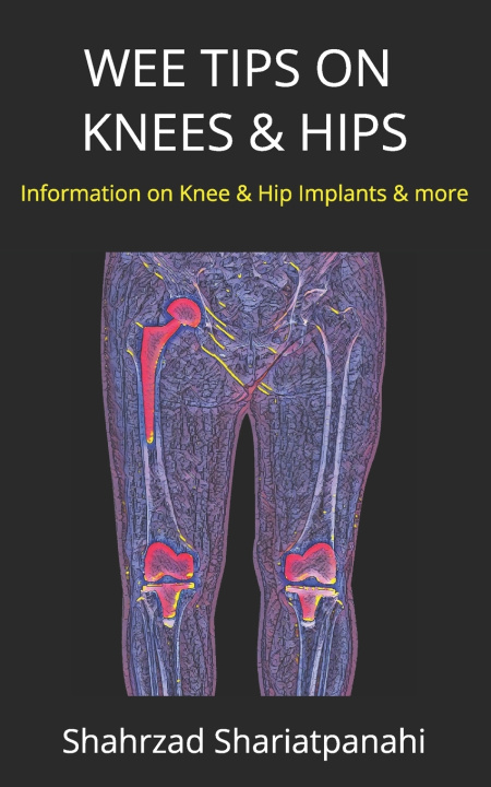 Knjiga Wee Tips on Knees & Hips Shariatpanahi Shahrzad Shariatpanahi