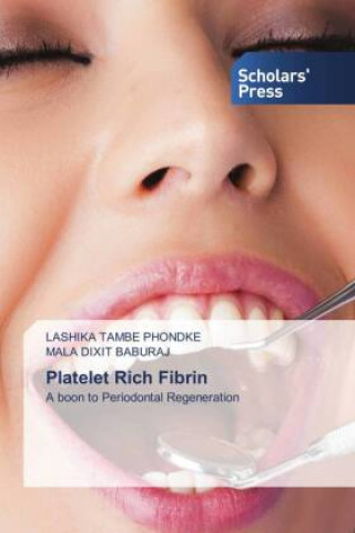 Knjiga Platelet Rich Fibrin Mala Dixit Baburaj