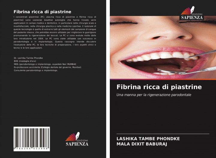Kniha Fibrina ricca di piastrine Mala Dixit Baburaj