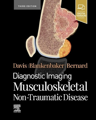 Kniha Diagnostic Imaging: Musculoskeletal Non-Traumatic Disease Kirkland W. Davis