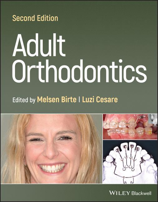Könyv Adult Orthodontics 2nd Edition 