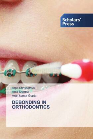 Kniha Debonding in Orthodontics Amil Sharma