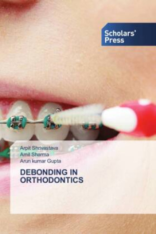 Knjiga Debonding in Orthodontics Amil Sharma