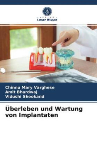 Kniha UEberleben und Wartung von Implantaten Amit Bhardwaj