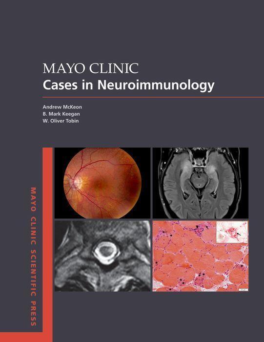 Kniha Mayo Clinic Cases in Neuroimmunology 