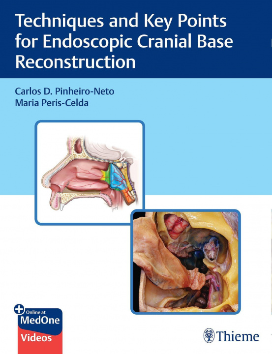 Knjiga Techniques and Key Points for Endoscopic Cranial Base Reconstruction Maria Peris-Celda